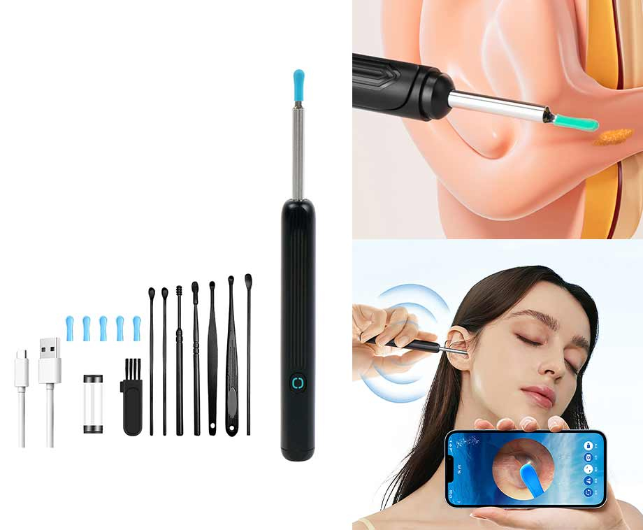 Earwizard Oorreiniger Met Camera – Haarscherpe Inspecties Binnen Handbereik … post thumbnail image
